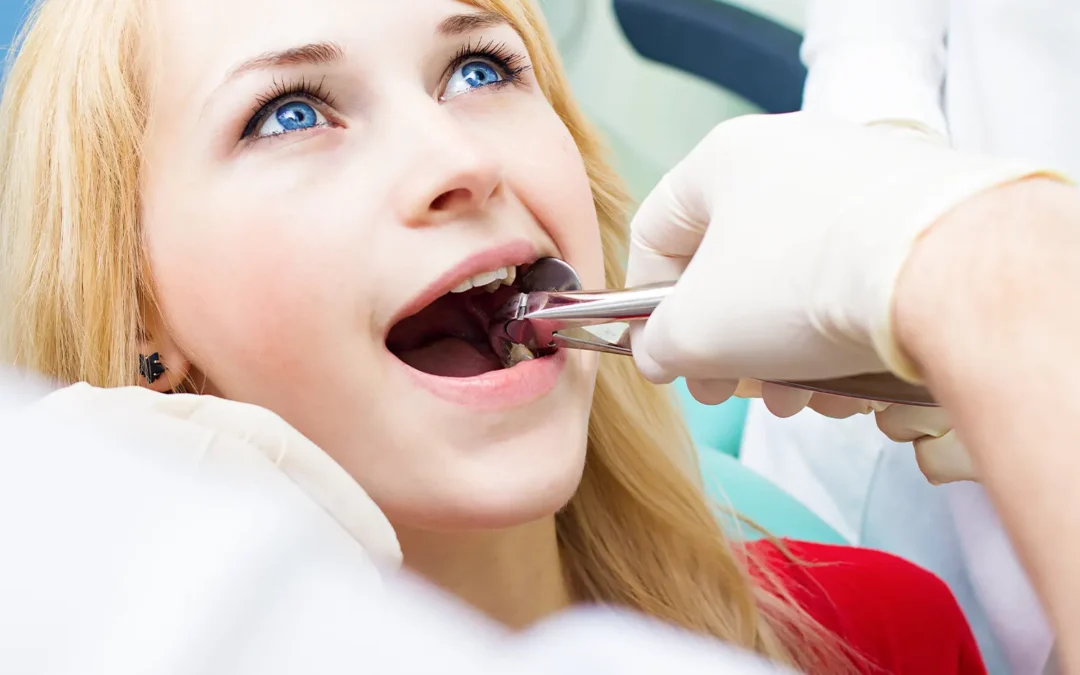 wisdom tooth extractions in Jacksonville