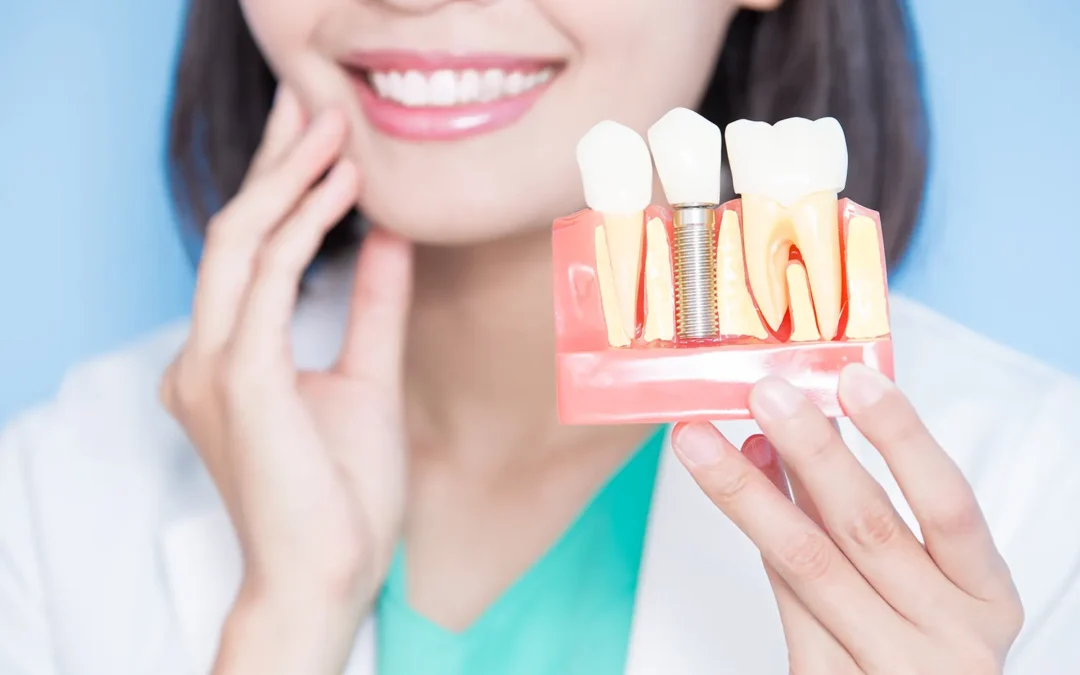 How Long Does a Dental Implant Last?