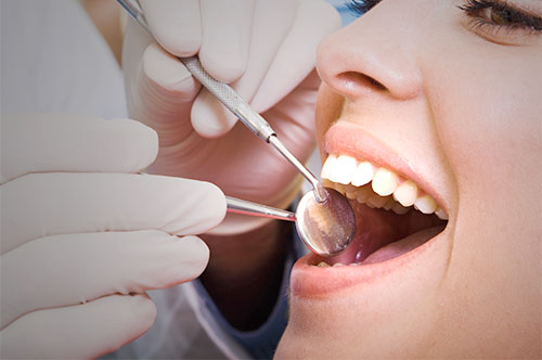 5 Tips to Save on Smile Care